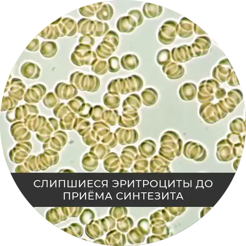 सिंथेसिट लेने से पहले जुड़ी हुई लाल रक्त कोशिकाएं